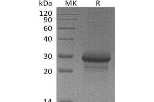 Western Blotting (WB) image for Mannose-Binding Lectin (Protein C) 2, Soluble (MBL2) protein (ABIN7320615) (MBL2 Protein)