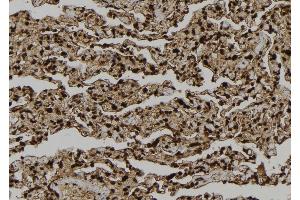 ABIN6277729 at 1/100 staining Human lung tissue by IHC-P.