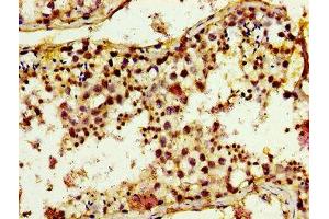 Immunohistochemistry of paraffin-embedded human testis tissue using ABIN7173435 at dilution of 1:100 (TRIM3 antibody  (AA 285-487))