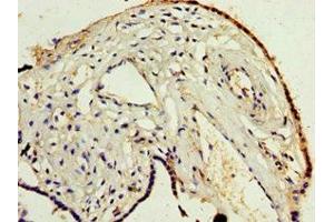 Immunohistochemistry of paraffin-embedded human placenta tissue using ABIN7150056 at dilution of 1:100 (ADAM33 antibody  (AA 140-420))