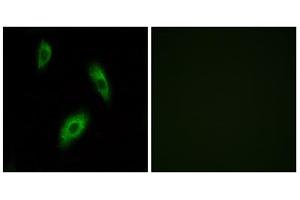 Immunofluorescence analysis of LOVO cells, using GPR174 antibody. (GPR174 antibody  (Internal Region))