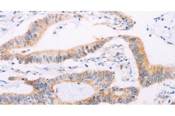 ADAMTS16 antibody