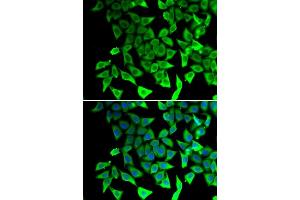 Immunofluorescence analysis of  cells using PTGES2 antibody (ABIN6129084, ABIN6146403, ABIN6146405 and ABIN6217438). (PTGES2 antibody  (AA 88-377))