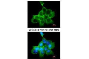 ICC/IF Image Immunofluorescence analysis of methanol-fixed A431, using DOCK1/180, antibody at 1:200 dilution. (DOCK1 antibody  (C-Term))