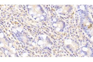 Detection of GNb2 in Human Small intestine Tissue using Polyclonal Antibody to G Protein Beta 2 (GNb2) (GNB2 antibody  (AA 2-340))