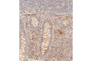 Immunohistochemical analysis of paraffin-embedded human epityphlon tissue using (ABIN392563 and ABIN2842106) performed on the Leica® BOND RXm. (PIK3CD antibody  (C-Term))