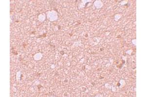 Immunohistochemical staining of human brain cells with SESTD1 polyclonal antibody  at 5 ug/mL. (SESTD1 antibody  (C-Term))