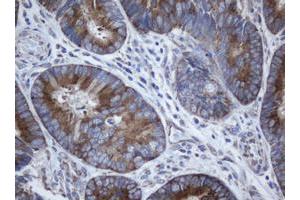 Image no. 2 for anti-SERPINE1 mRNA Binding Protein 1 (SERBP1) (AA 1-262) antibody (ABIN1490678) (SERBP1 antibody  (AA 1-262))