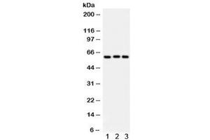 Western blot testing of 1) rat liver, 2) human placenta, 3) A549 lysate with Heparanase 1 antibody. (HPSE antibody)