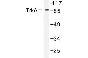 Image no. 1 for anti-Neurotrophic Tyrosine Kinase, Receptor, Type 1 (NTRK1) antibody (ABIN272088)