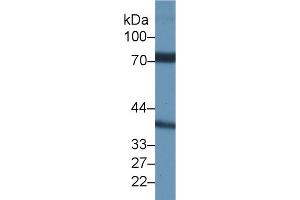 Western Blot; Sample: Rat Testis lysate; Primary Ab: 1µg/ml Rabbit Anti-Rat NCSTN Antibody Second Ab: 0. (Nicastrin antibody  (AA 35-534))