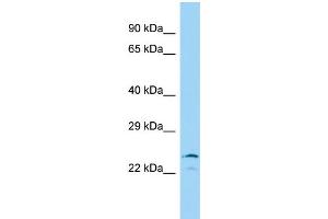 Host: Rabbit Target Name: IYD Sample Type: 293T Whole Cell lysates Antibody Dilution: 1. (IYD antibody  (N-Term))