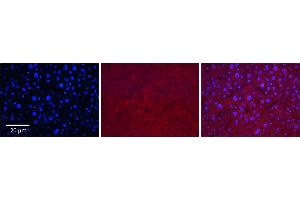 Rabbit Anti-SLC37A4 Antibody      Formalin Fixed Paraffin Embedded Tissue: Human Adult Liver   Observed Staining: Cytoplasm in hepatocytes, weak signal, low tissue distribution   Primary Antibody Concentration: 1:100  Secondary Antibody: Donkey anti-Rabbit-Cy3  Secondary Antibody Concentration: 1:200  Magnification: 20X  Exposure Time: 0. (SLC37A4 antibody  (Middle Region))