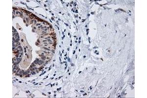 Immunohistochemical staining of paraffin-embedded breast tissue using anti-MCL1 mouse monoclonal antibody. (MCL-1 antibody)