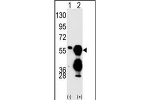 Western blot analysis of M1F (arrow) using M1F Antibody (C-term) (ABIN392884 and ABIN2842288). (PPM1F antibody  (C-Term))