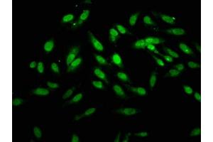 Immunofluorescence staining of Hela cells with ABIN7155739 at 1:166, counter-stained with DAPI. (HOXB4 antibody  (AA 88-166))