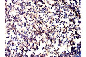 Immunohistochemical analysis of paraffin-embedded tonsil tissues using CD11a mouse mAb with DAB staining. (ITGAL antibody  (AA 26-194))