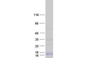 Western Blotting (WB) image for Exoribonuclease 1 (ERI1) protein (Myc-DYKDDDDK Tag) (ABIN2720477)