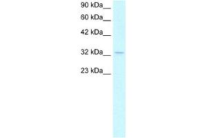 WB Suggested Anti-NPM1 Antibody Titration:  1. (NPM1 antibody  (C-Term))