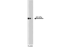 Western blot analysis of Hsp60 on a Jurkat lysate (ABIN968537). (HSPD1 antibody)