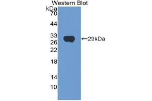 Detection of Recombinant HEXa, Human using Polyclonal Antibody to Hexosaminidase A Alpha (HEXa) (Hexosaminidase A antibody  (AA 318-529))