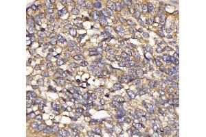 IHC analysis of IFIT5 using anti-IFIT5 antibody (ABIN7600752). (IFIT5 antibody  (AA 23-439))