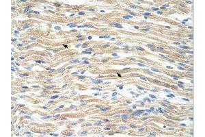 Image no. 1 for anti-Exosome Component 6 (EXOSC6) (N-Term) antibody (ABIN202141)