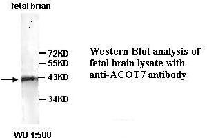 Image no. 1 for anti-Acyl-CoA Thioesterase 7 (ACOT7) (C-Term) antibody (ABIN791079) (ACOT7 antibody  (C-Term))
