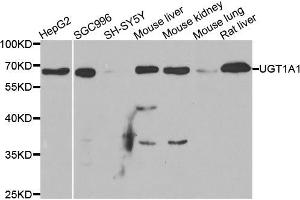 Western blot analysis of extracts of various cell lines, using μgT1A1 antibody (ABIN5973637) at 1/1000 dilution. (UGT1A1 antibody)