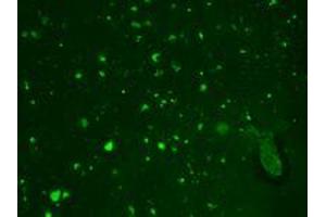 Image no. 3 for anti-Hyperpolarization Activated Cyclic Nucleotide-Gated Potassium Channel 2 (HCN2) (AA 761-863) antibody (ABIN361764)