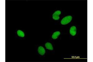 Immunofluorescence of purified MaxPab antibody to HIRIP3 on HeLa cell. (HIRIP3 antibody  (AA 1-556))