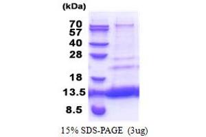 SDS-PAGE (SDS) image for C-X(9)-C Motif Containing 4 Homolog (CMC4) (AA 1-68) protein (His tag) (ABIN5853372)