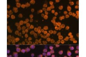 Immunofluorescence analysis of THP-1 cells using TNFRSF10A Polyclonal Antibody at dilution of 1:100 (40x lens). (TNFRSF10A antibody)