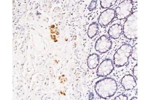 Formalin-fixed and paraffin embedded rat colon tissue labeled with Anti-TFPI-2 Polyclonal Antibody, Unconjugated at 1:200 followed by conjugation to the secondary antibody and DAB staining (TFPI2 antibody  (AA 135-235))