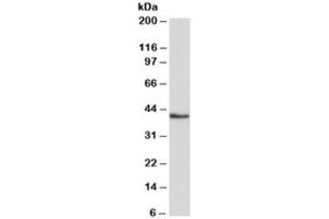 Western blot testing of K562 lysate with HMBS antibody at 0. (HMBS antibody)