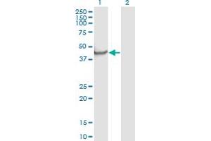 Western Blot analysis of NPTX1 expression in transfected 293T cell line by NPTX1 monoclonal antibody (M06), clone 7E6. (NPX1 antibody  (AA 141-240))