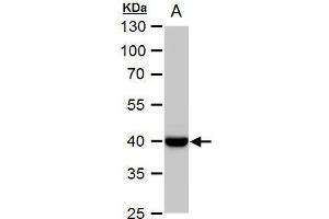 WB Image WNT11 antibody detects WNT11 protein by western blot analysis. (WNT11 antibody  (Center))