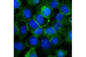 IF analysis of P cadherin/CDH3 using anti-P cadherin/CDH3 antibody (ABIN6719500). (P-Cadherin antibody  (AA 126-336))