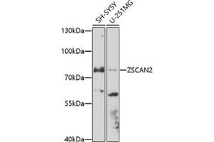 Western blot analysis of extracts of various cell lines, using ZSC antibody (ABIN7271442) at 1:1000 dilution. (ZSCAN2 antibody  (AA 50-150))