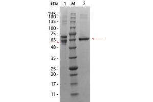 AKT3 Protein