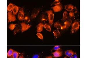 Immunofluorescence analysis of HeLa cells using IGFBP5 Polyclonal Antibody at dilution of 1:100. (IGFBP5 antibody)