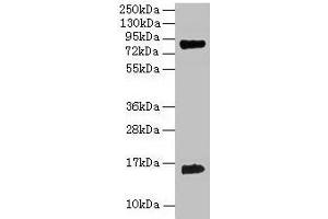Western blot All lanes: Hemoglobin polyclonal antibody at 2 μg/mL + 293T whole cell lysate Secondary Goat polyclonal to rabbit IgG at 1/15000 dilution Predicted band size: 16 kDa Observed band size: 16 kDa (Hemoglobin antibody)