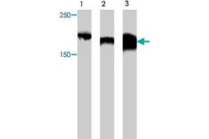 ZBTB38 anticorps