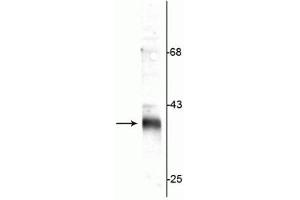 Western blot of rat synaptic plasma membrane (SPM) lysate showing specific immunolabeling of the ~36 kDa stargazin protein. (Stargazin antibody  (C-Term))