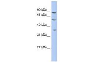 Image no. 1 for anti-Family with Sequence Similarity 63, Member A (FAM63A) (C-Term) antibody (ABIN6744032) (FAM63A antibody  (C-Term))