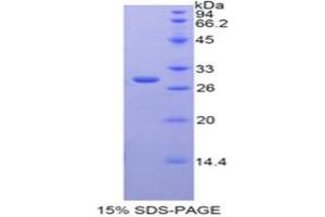 SDS-PAGE analysis of Rat GAL3ST1 Protein. (GAL3ST1 Protein)