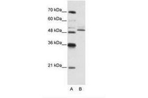 Image no. 3 for anti-Zinc Finger Protein 296 (ZNF296) (C-Term) antibody (ABIN6736191)