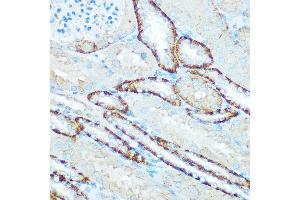 Immunohistochemistry of paraffin-embedded mouse kidney using H Rabbit pAb (ABIN6131125, ABIN6137333, ABIN6137334 and ABIN6220624) at dilution of 1:100 (40x lens). (ATP5H antibody  (AA 1-161))