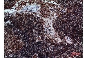 Immunohistochemistry (IHC) image for anti-Natural Cytotoxicity Triggering Receptor 2 (NCR2) (Internal Region) antibody (ABIN6287316)