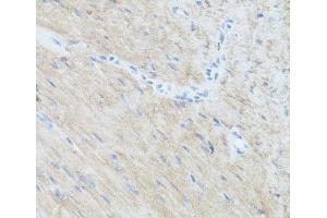 Immunohistochemistry of paraffin-embedded Mouse heart using CLUH Polyclonal Antibody at dilution of 1:100 (40x lens). (CLUH antibody)